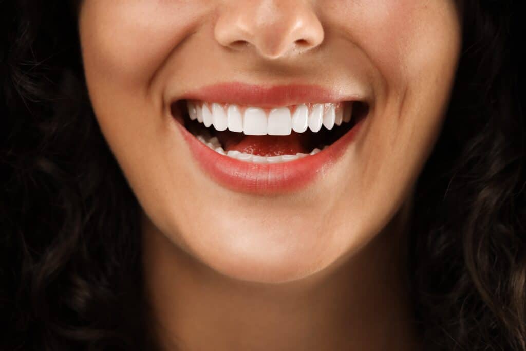 5 Transformative Benefits of a Smile Makeover in St. George at Guardian Family Dental